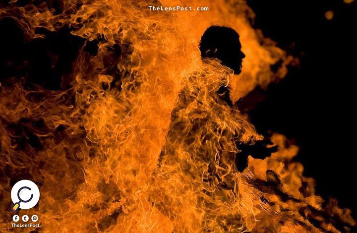 شاب من "البدون" يشعل النار في جسده بالكويت