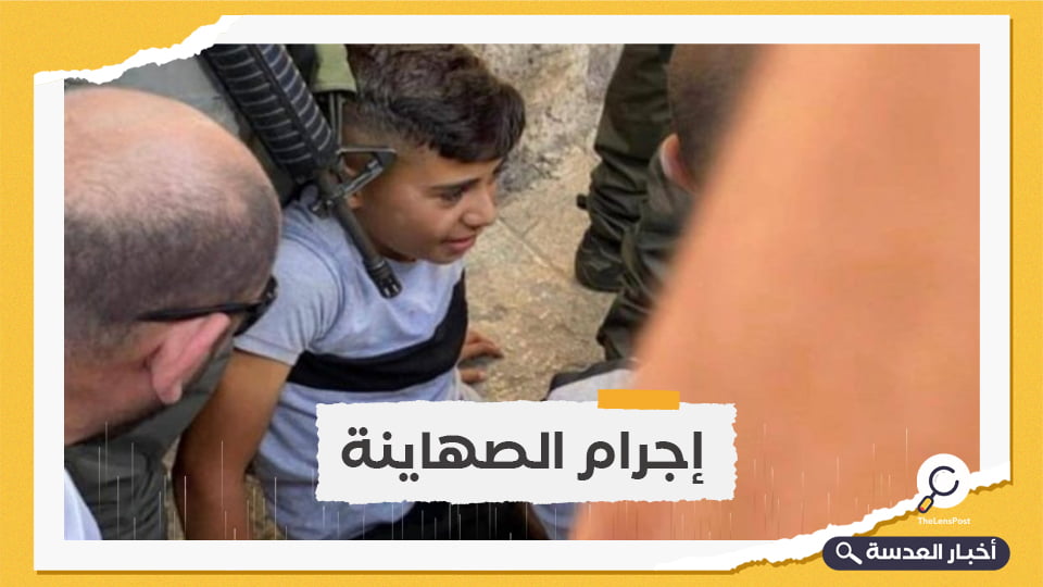 شرطة الاحتلال تدهس طفلًا فلسطينيًا بالقدس المحتلة
