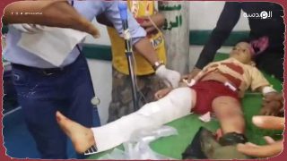 إصابة 11 طفل يمني بهجوم للحوثي على تعز